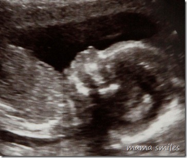 Our fourth child