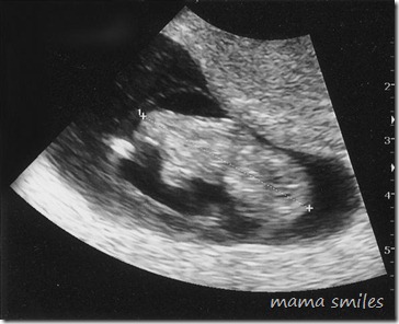 Baby Four